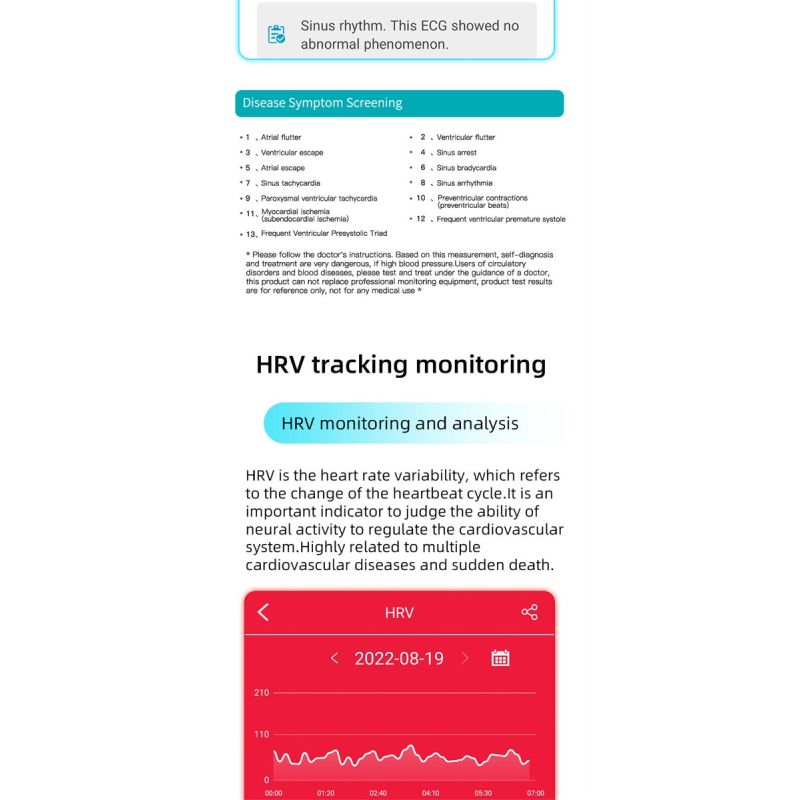 EP01 Smartwatch Bracciale Fitness Tracker: Glucosio, ECG, HRV, Cardio, Temp. 1.47