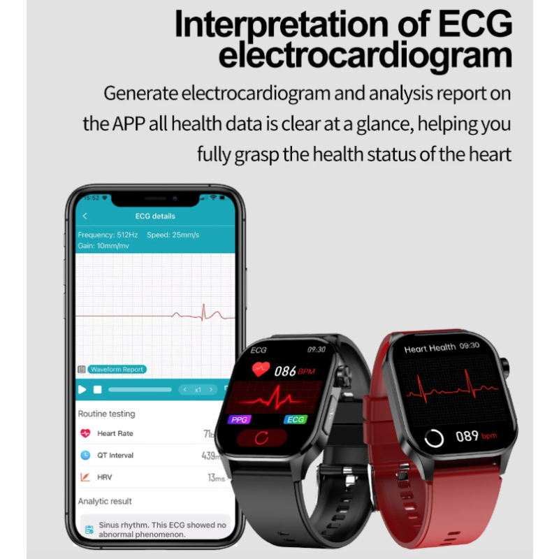 E580 Smartwatch glice mia ECG, pressione. Display 2.04