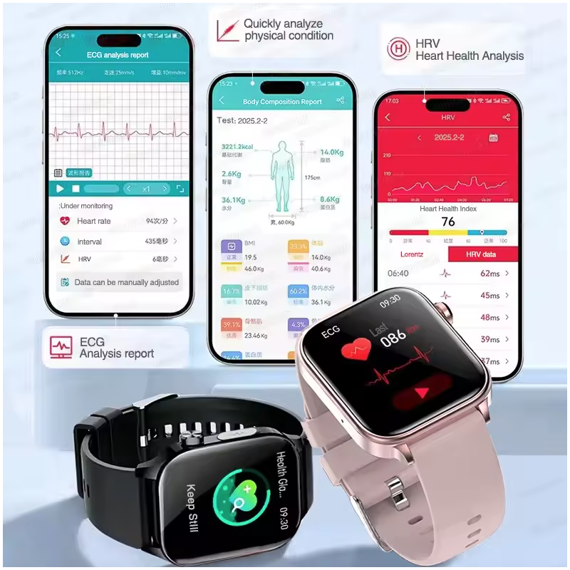 ET585 Smartwatch ECG PPG Uomo Donna Orologio Intelligente Diagnosi AI Benessere Fitness