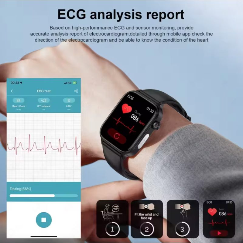 ET585 Smartwatch ECG PPG Uomo Donna Orologio Intelligente Diagnosi AI Benessere Fitness