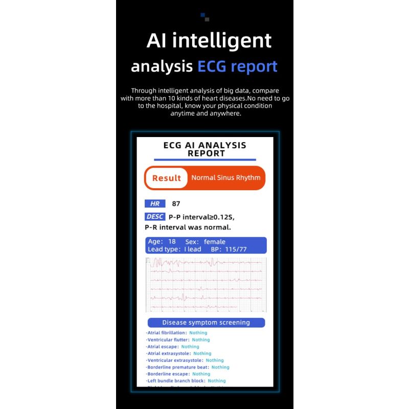 W11 Smart Watch 1.32