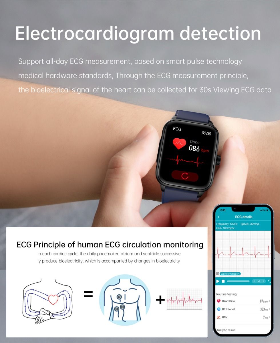 ET540 Glicemia ECG Temperatura corporea Pressione sanguigna Ossigeno nel sangue Frequenza cardiaca Chiamate Bluetooth Smartwatch Fitness Tracker