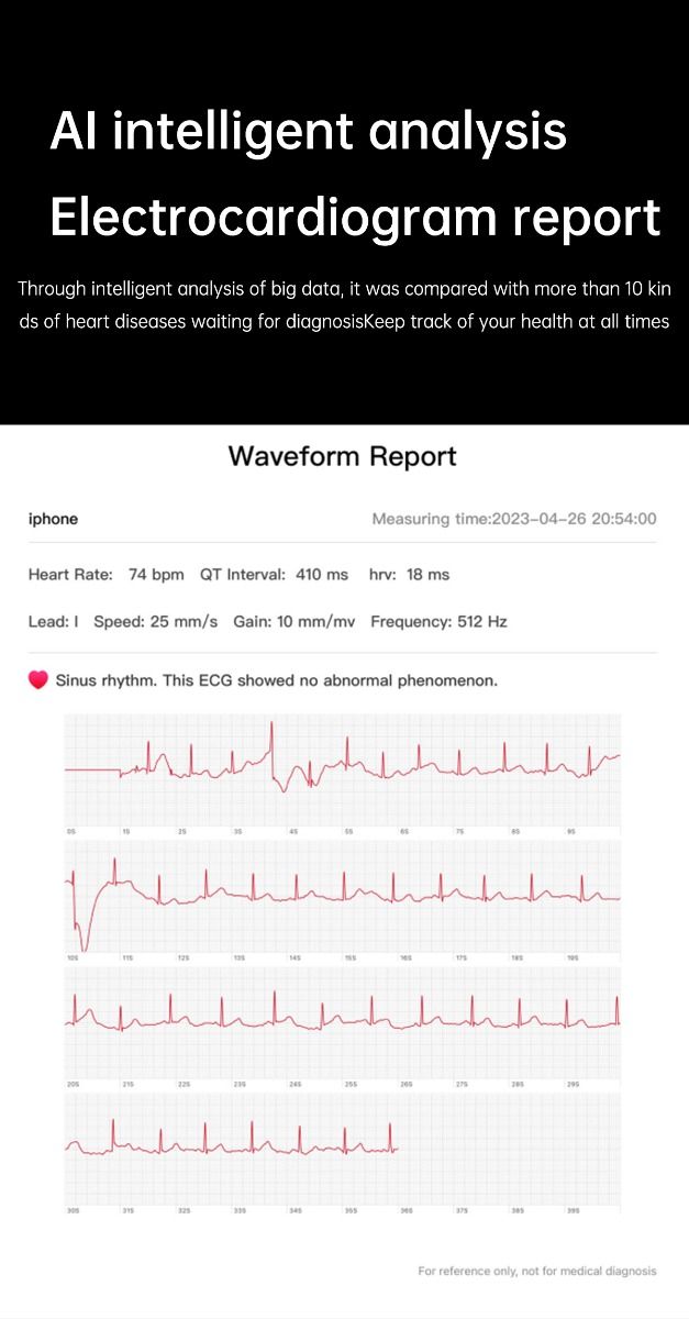 ET540 Glicemia ECG Temperatura corporea Pressione sanguigna Ossigeno nel sangue Frequenza cardiaca Chiamate Bluetooth Smartwatch Fitness Tracker