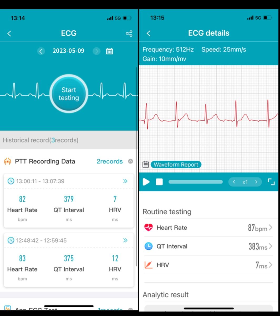 ET540 Glicemia ECG Temperatura corporea Pressione sanguigna Ossigeno nel sangue Frequenza cardiaca Chiamate Bluetooth Smartwatch Fitness Tracker