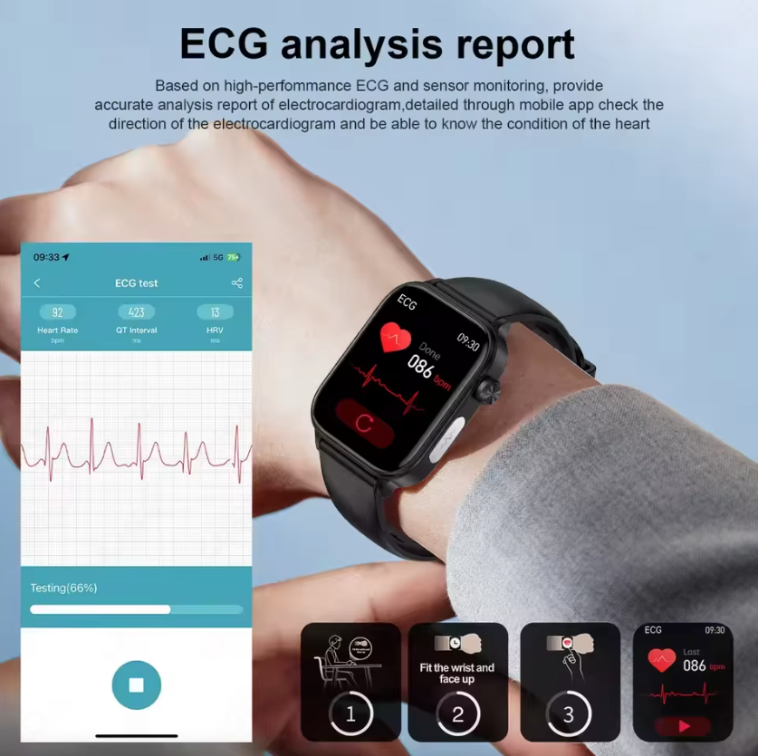 ET585 ECG+PPG AI Diagnosi Sanitaria Smartwatch Uomo Donna Orologio Lipidi Sangue BP Acido Urico Frequenza Cardiaca